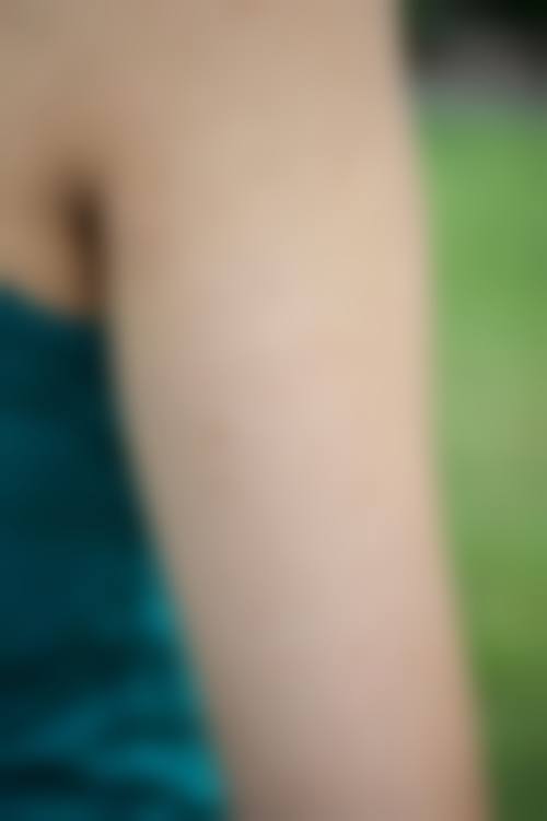 八、鄂尔多斯伊美尔医学美容诊所真实的患者评价