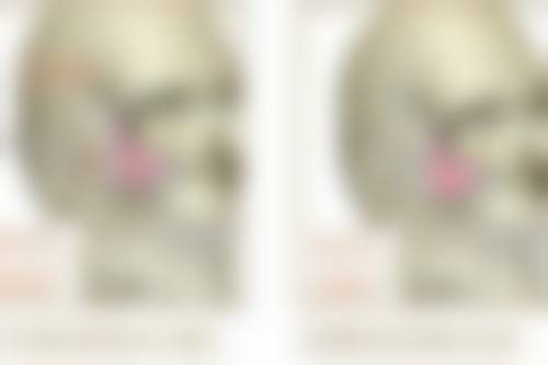 {狗咬伤留下疤痕怎么办？了解处理方法并附图片示例助你应对疤痕难题