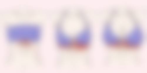 五、身上有疤痕能去除吗？特殊情况的处理