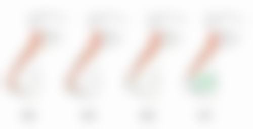 五、软骨隆鼻是恒久的吗？想找冯雁平做耳软骨隆鼻的须知信息