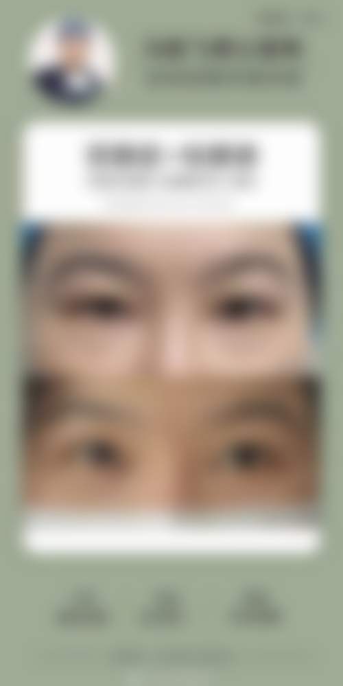 三、张朝蕾技术优势