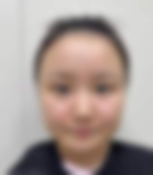 六、张朝蕾真实的患者评价