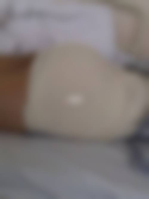 八、成都温江艺桥医学美容诊所真实的患者评价