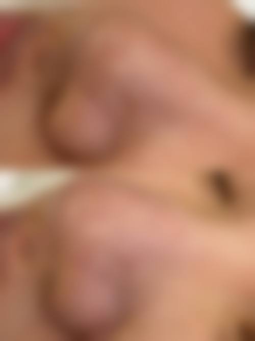 八、宁波市熙美医疗美容门诊部真实的患者评价