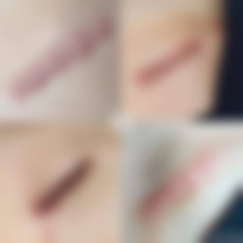 八、江西姣典医疗美容门诊部真实的患者评价