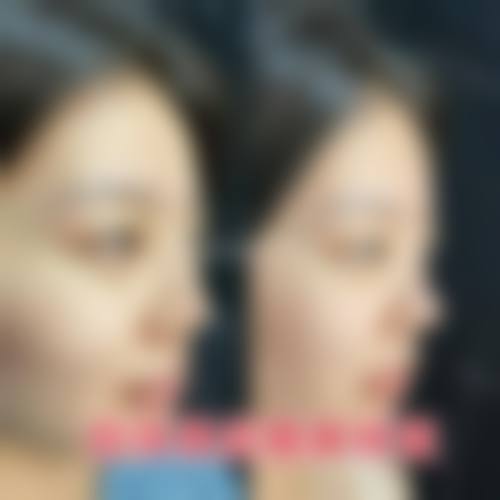 二、杭州上颜医疗美容怎么样？