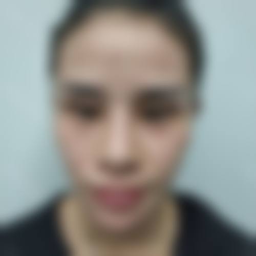 四、杭州上颜医疗美容特色项目