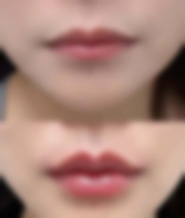 四、图片示例助你应对疤痕难题