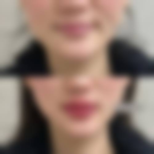 二、河南新乡名门医疗美容怎么样？