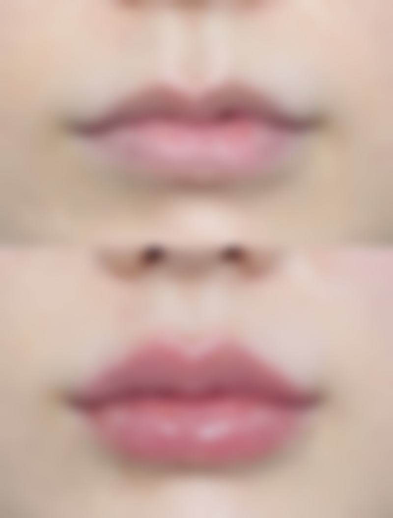 六、手术后的护理