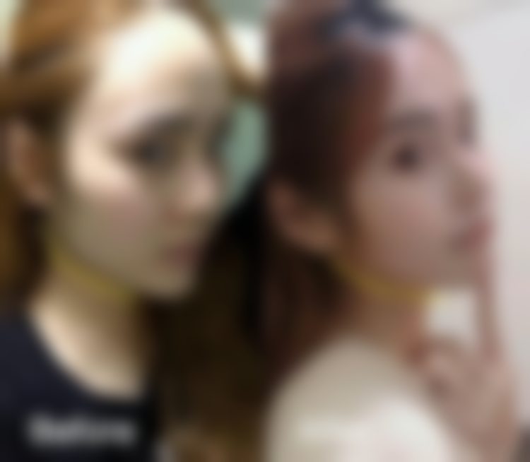 七、杭州连天美医疗美容医院外轮廓提升乔雅登玻尿酸套餐的未来发展