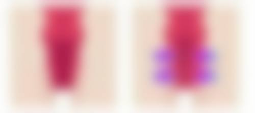 四、延长三点定位双眼皮维持时间的方法