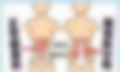 二、什么样的眼袋适合内切：与外切法对比