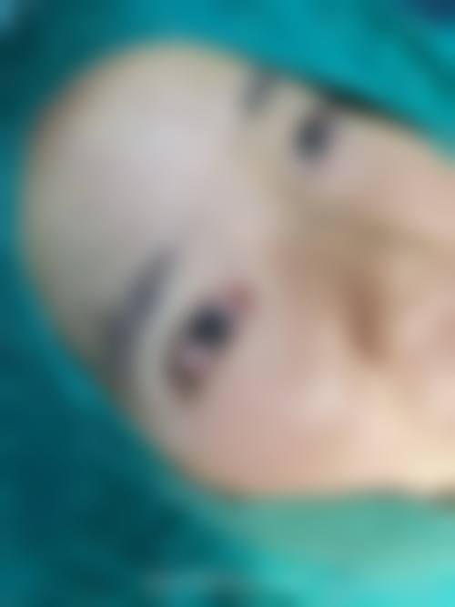 五、葫芦岛元辰整形医院价格表