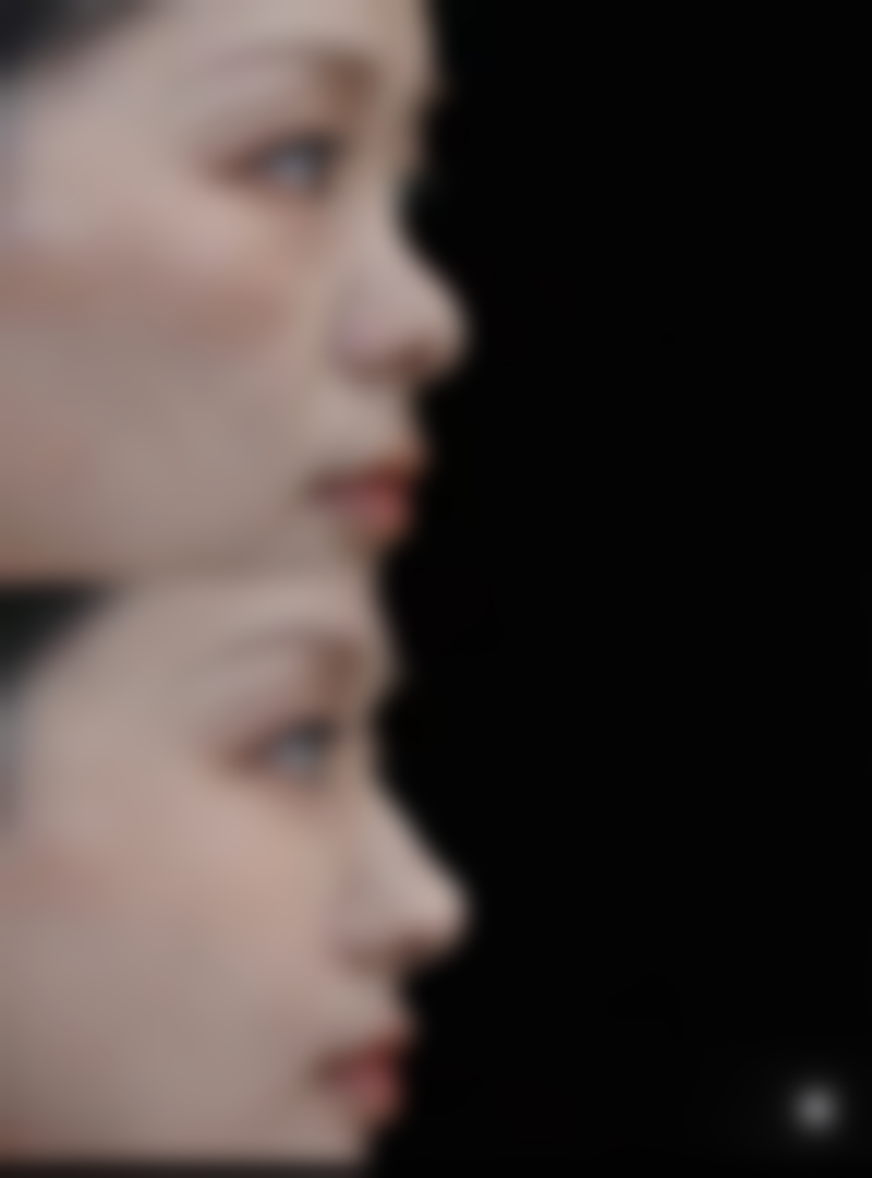 七、葫芦岛元辰整形医院预约方式