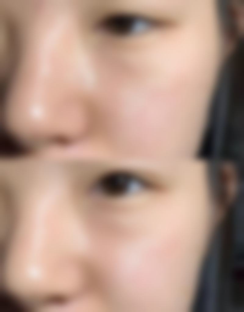 五、包皮手术和延长手术能一起做吗？总结