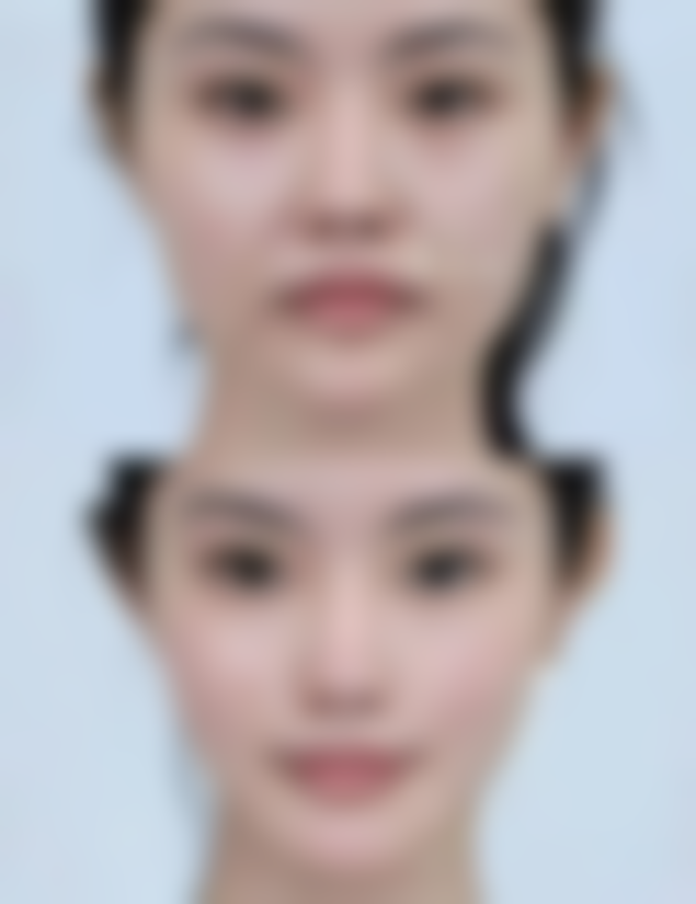 四、西安维多利亚医疗美容诊所特色项目