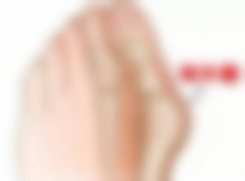 三、女生割双眼皮的从众心理与社交压力心态
