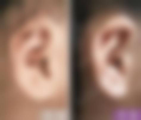 七、威海兰积医疗美容诊所预约方式