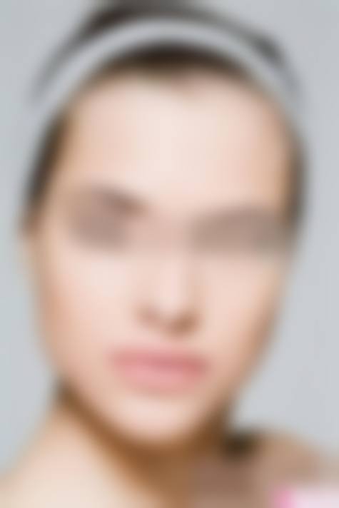 八、威海兰积医疗美容诊所真实的患者评价