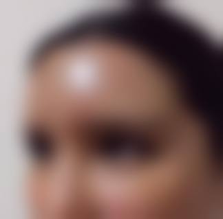 九、南通大学附属医院整形美容科真实的患者评价