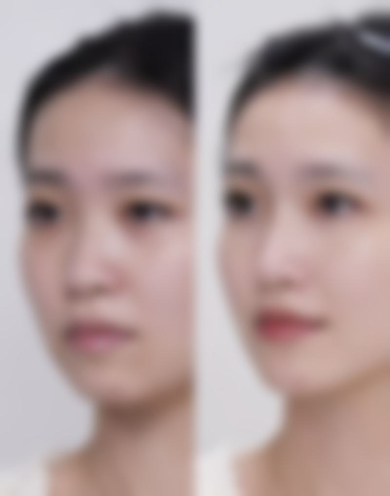 五、大连鑫来美医疗美容诊所价格表