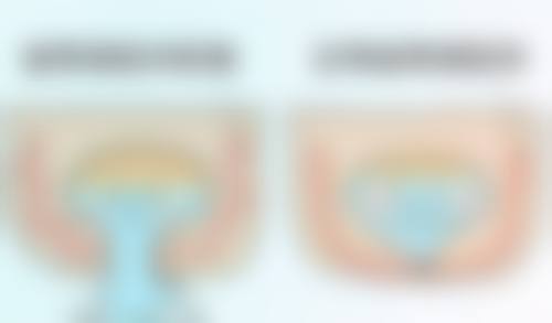 五、什么眼霜可以消除眼袋之视黄醇眼霜