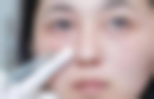 {怎样消除黑眼圈及眼袋？作息、护理、医美等多方式综合改善有妙招 