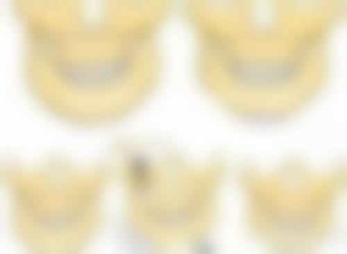 {什么人适合种植头发呢？雄激素性脱发、疤痕性脱发等患者了解一下 