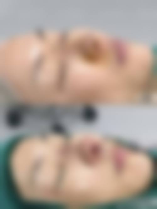 九、西安雁塔伊美尔门诊部真实的患者评价