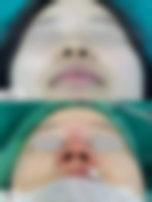 八、大连净妍医疗美容诊所真实的患者评价