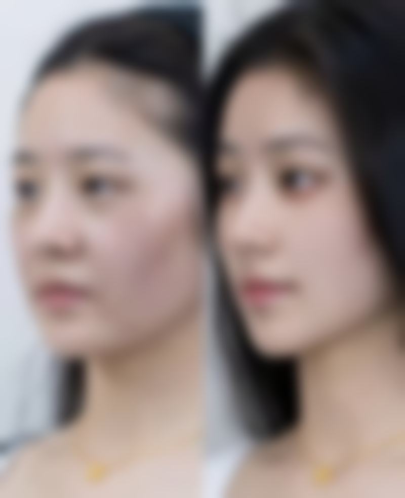 四、大连净妍医疗美容诊所特色项目