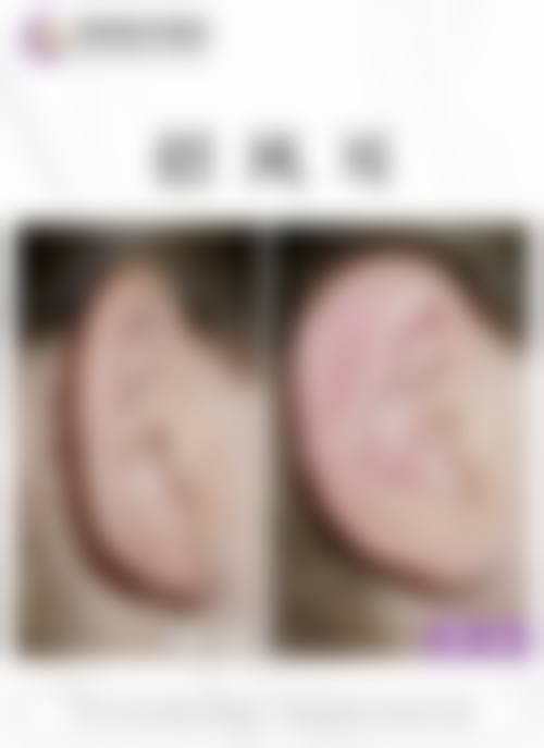 三、兰州诗丽堂澜悦医疗美容诊所诊疗项目有哪些？