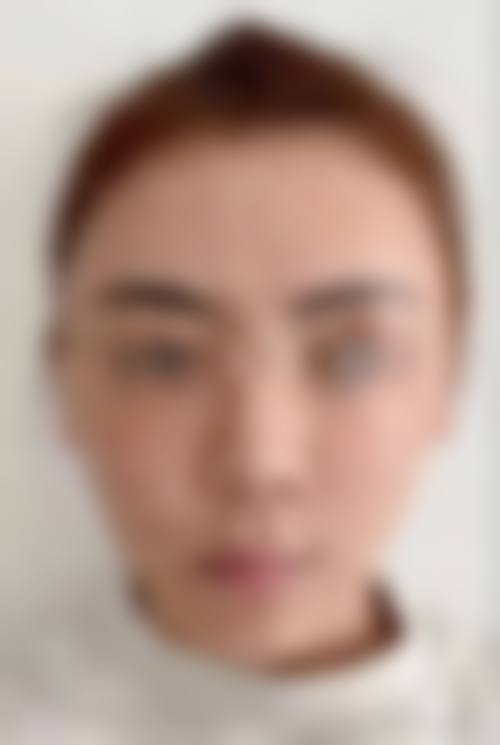 五、兰州诗丽堂澜悦医疗美容诊所价格表