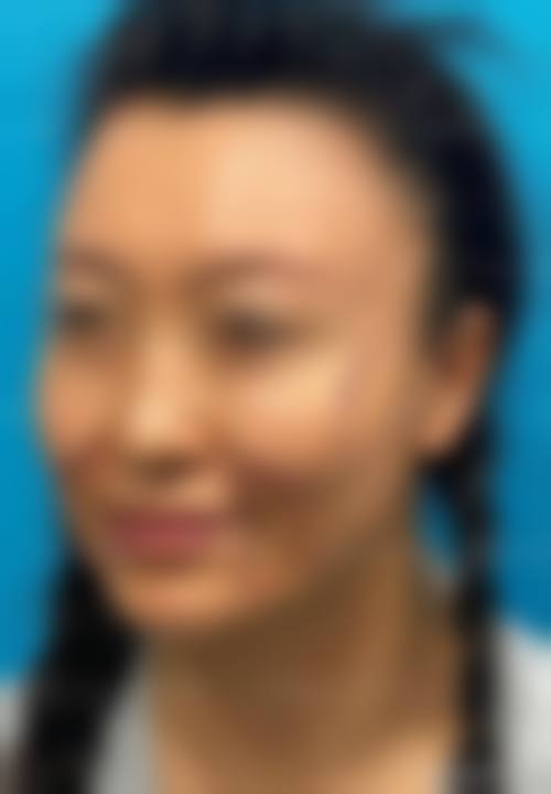 四、兰州诗丽堂澜悦医疗美容诊所特色项目