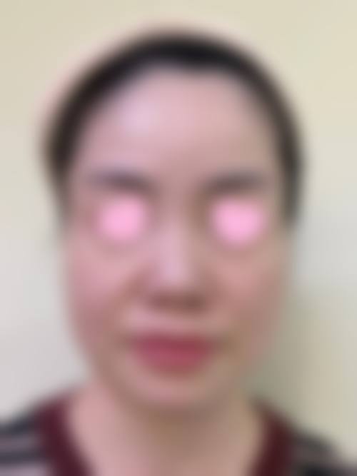 四、武汉市中 心医院医学整形美容科特色项目