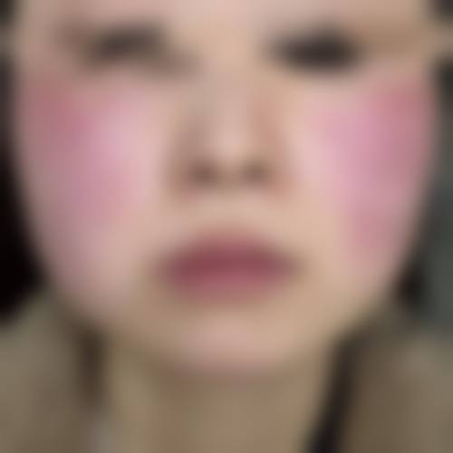 五、昆明西山区典雅阁整形美容诊所价格表