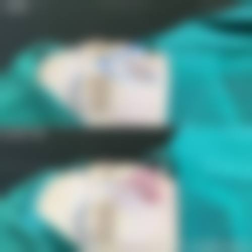 八、昆明西山区典雅阁整形美容诊所真实的患者评价