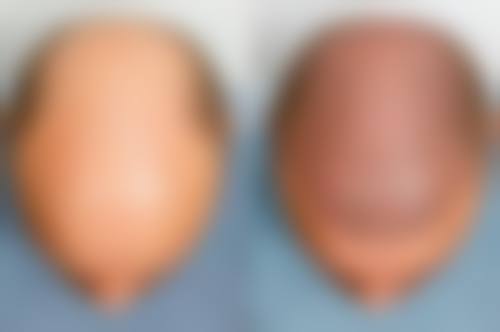 三、河北廊坊零皙医疗美容诊所诊疗项目有哪些？