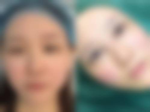 四、成都温江新威整形医院特色项目