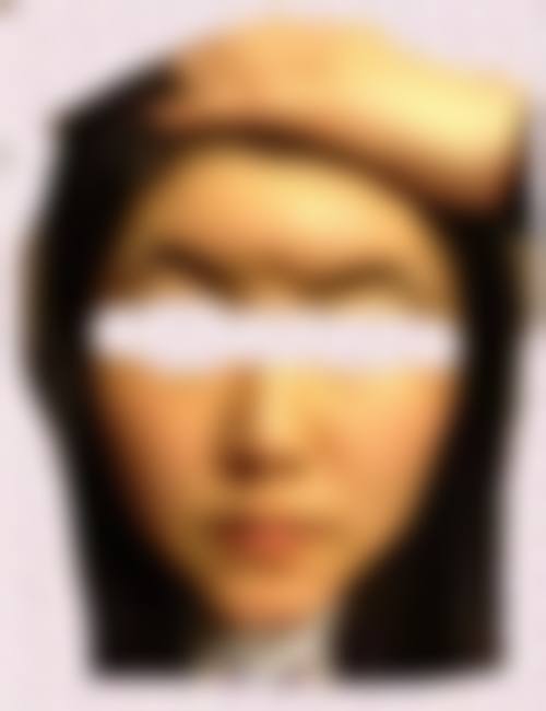 三、深圳中海医院整形美容科诊疗项目有哪些？