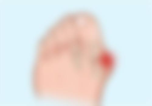 四、选择韩式双眼皮手术的要点