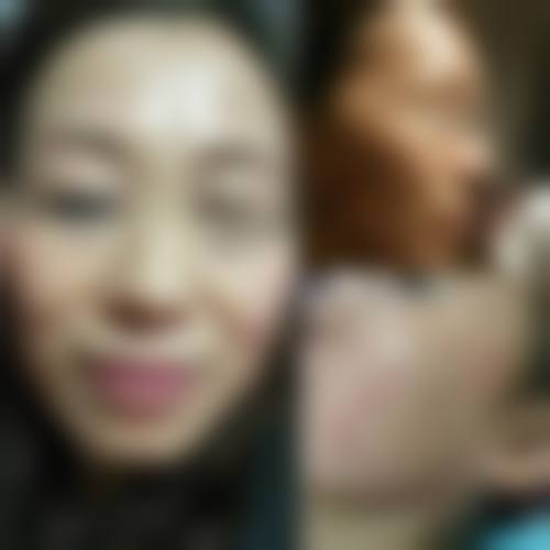 九、石河子芸菲医疗美容诊所真实的患者评价