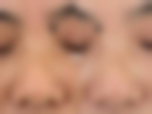 五、广州愈生医院整形美容中 心价格表