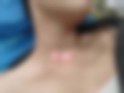 四、广州愈生医院整形美容中 心特色项目