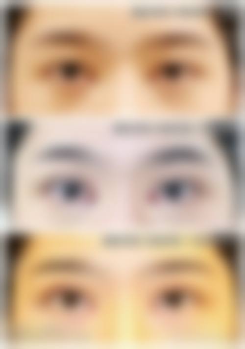 七、广州愈生医院整形美容中 心预约方式
