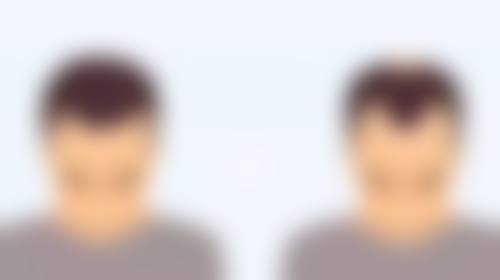 三、辽宁曙光整形外科医院双眼皮手术的优势