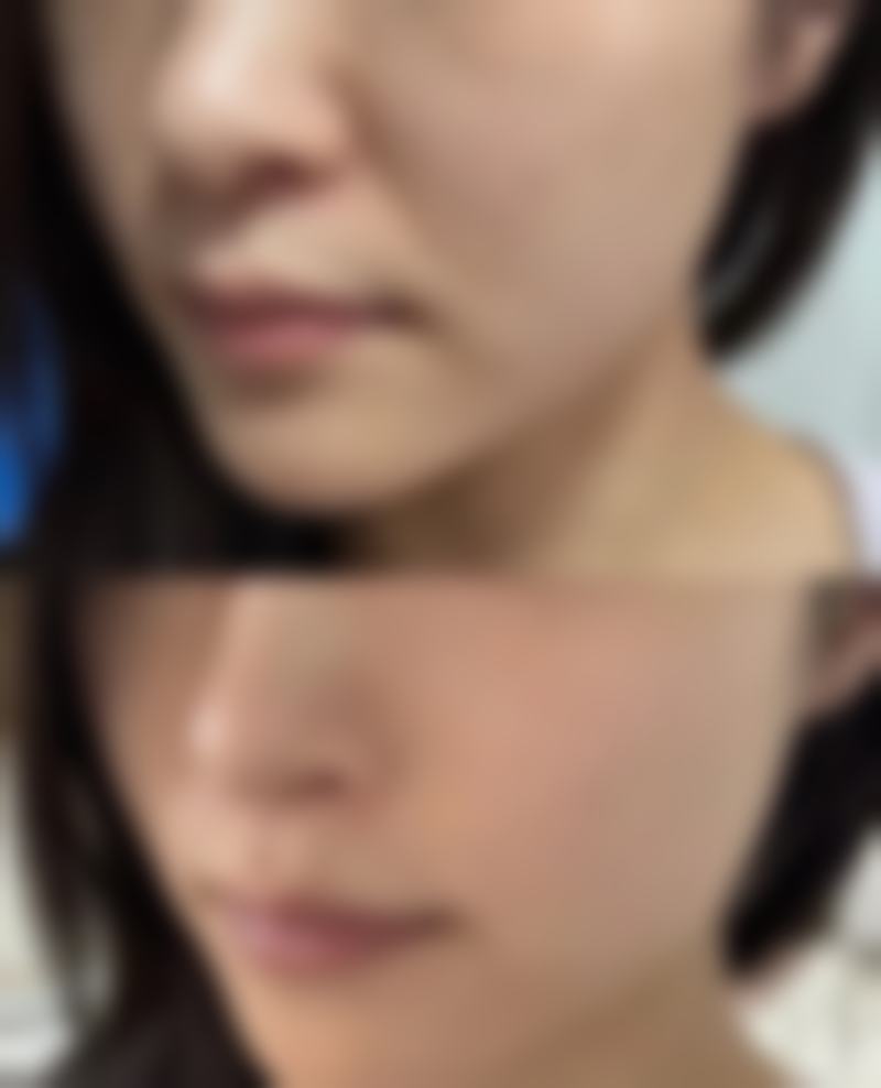 六、灵宝维蜜医疗美容诊所价格表