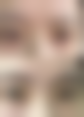 {隆鼻25天可以吃海鲜吗？了解食用海鲜对隆鼻恢复有无影响很重要！ 