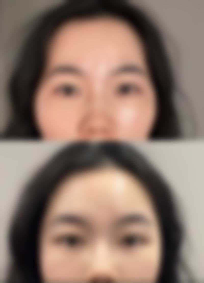 {那里双眼皮做的比较好？辽宁曙光整形外科医院打造自然妈生款双眼皮超好看！ 